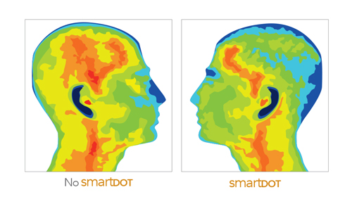 SmartDOT Before and After