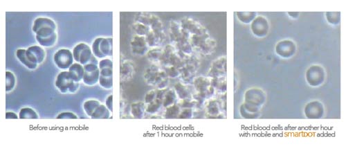 SmartDOT Before and After